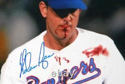 Photo encadrée autographiée de Nolan Ryan 8x10 des Rangers avec la lèvre ensanglantée PSA/DNA